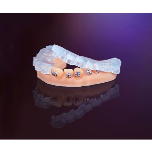 KeyOrtho-IBT_3